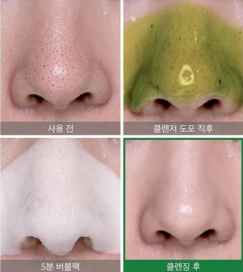 SOME BY MI Bye Bye Blackhead 30 Days Miracle Green Tea Tox Bubble Cleanser Pimple Acne Treatment Removal Exfoliating