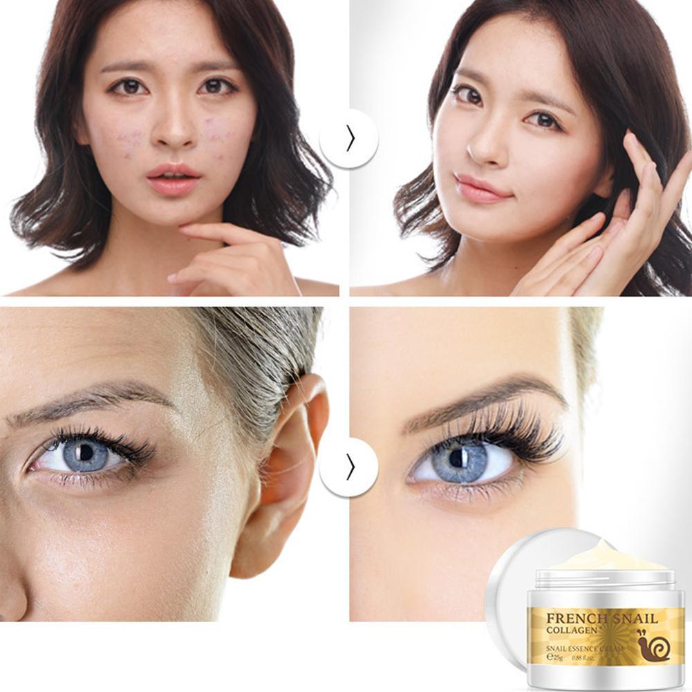 Snail Rejuvenating Face Cream Hyaluronic Acid Moisturizer Anti Aging Collagen Skin Care Health Nourishing Serum