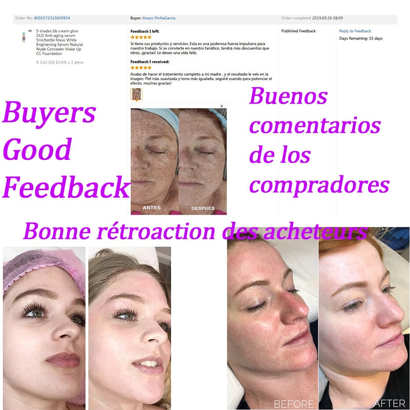 12 PCS Korea Brand bb cream glow jakarta treament murch blush whitening meso serum foundation  Booster original Starter Kit