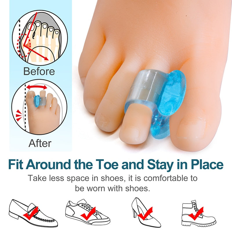 Sumifun Blue Soft Silicone Gel Toe Separator Hallux Valgus Bunion Spacers Thumb Corrector Foot Care Tool 1Pairs/2pcs